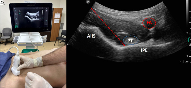 Figure 9. A, B.