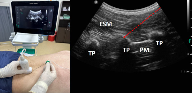 Figure 7. A, B.