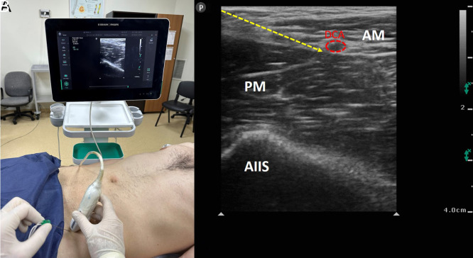 Figure 10. A, B.