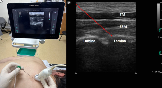 Figure 1. A, B.