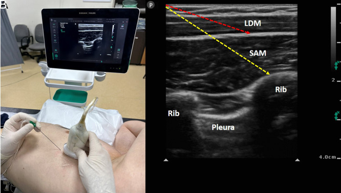 Figure 4. A, B.