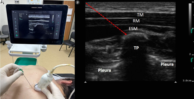 Figure 2. A, B.