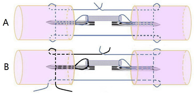 Figure 4