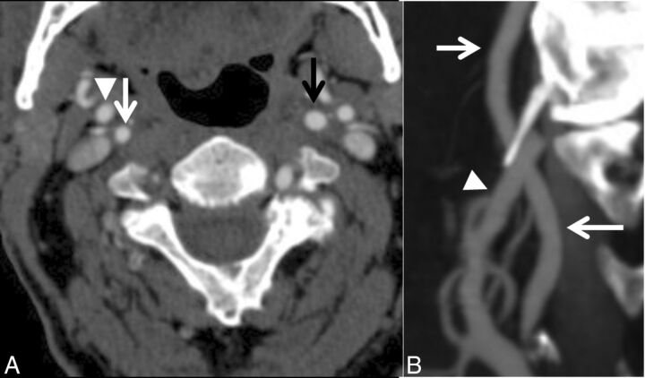 Fig 4.