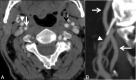 Fig 4.