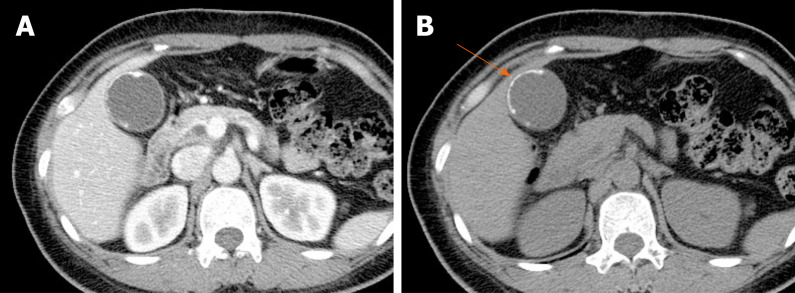 Figure 21