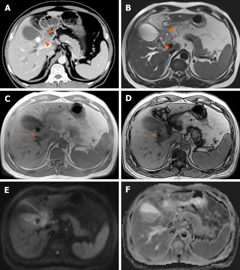 Figure 18