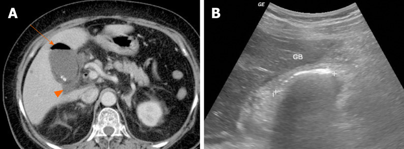 Figure 14