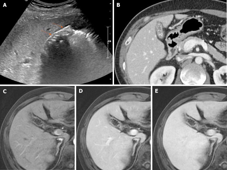 Figure 16