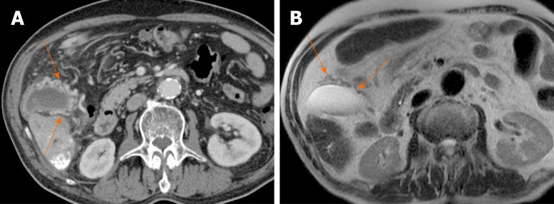 Figure 22