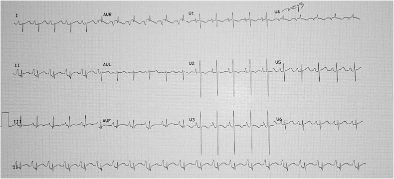 Fig 10