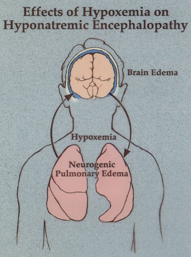 FIGURE 1: