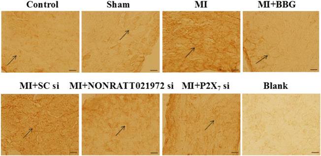 graphic file with name 11302_2020_9742_Figb_HTML.jpg