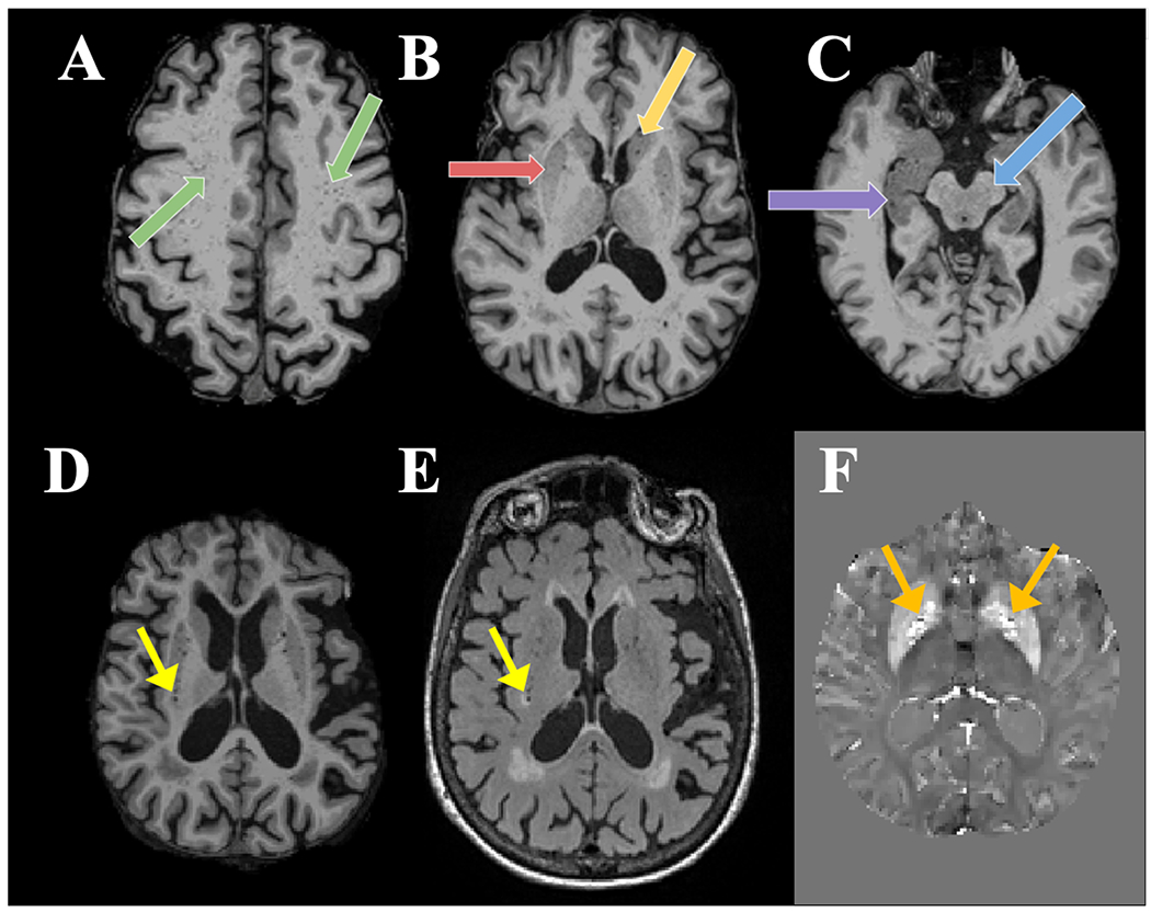 Figure 2: