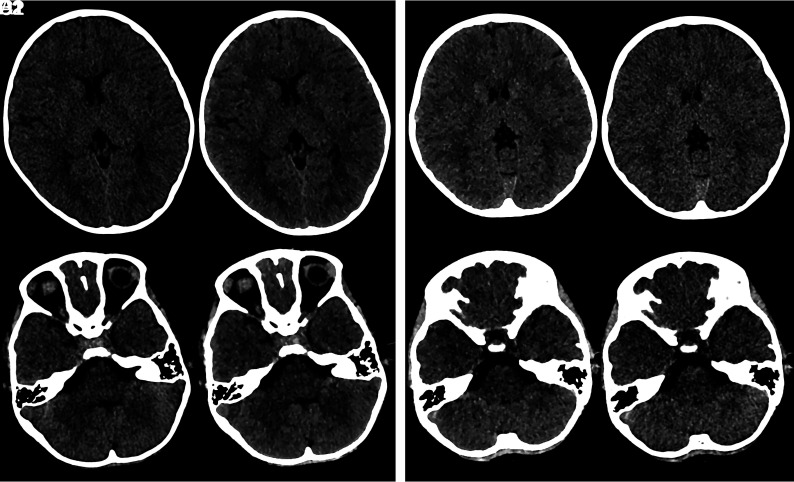 FIG 2.