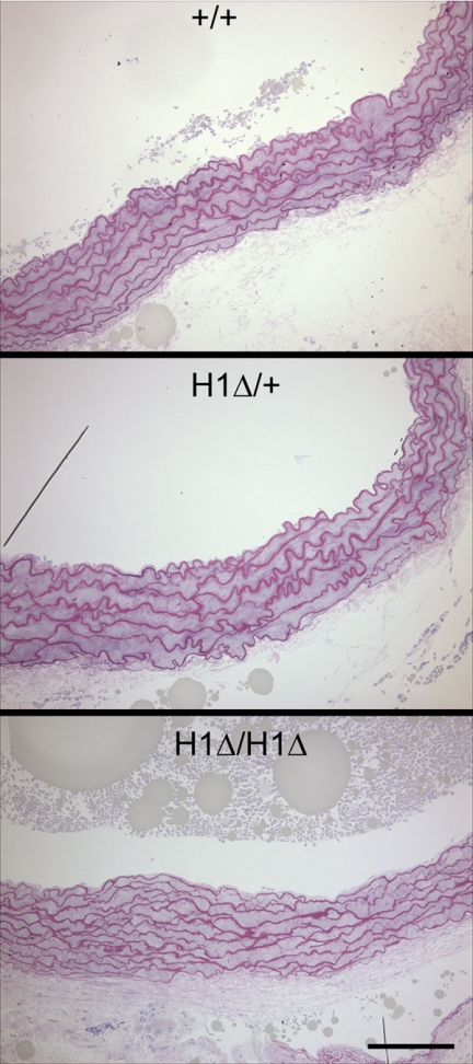 FIGURE 11.