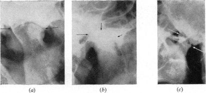 Fig. 11