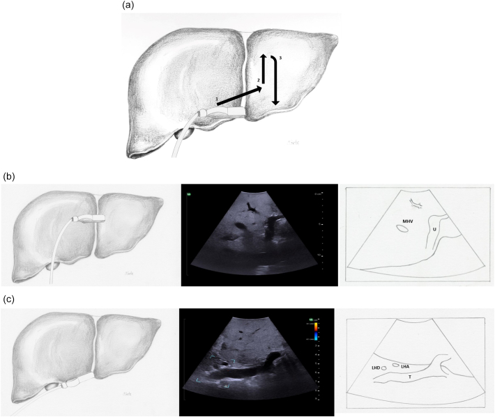 Fig. 18