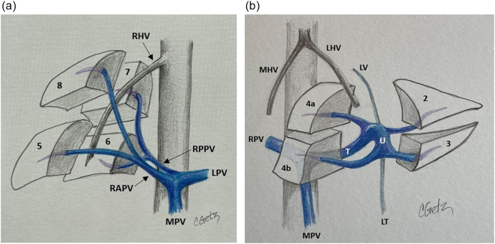 Fig. 15