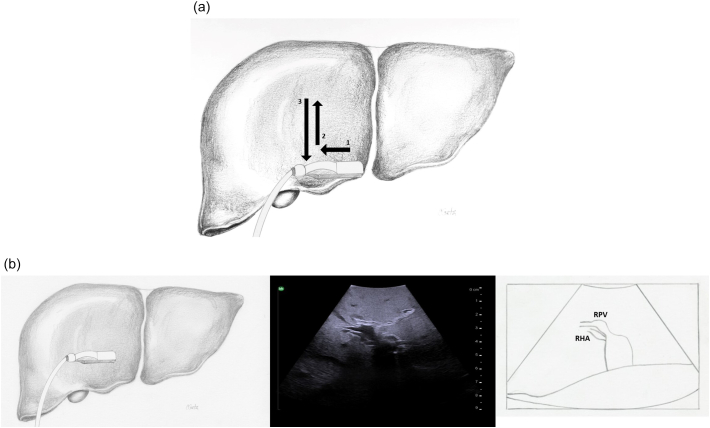 Fig. 21