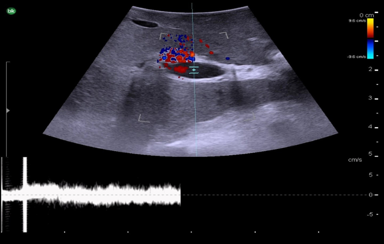 Fig. 14