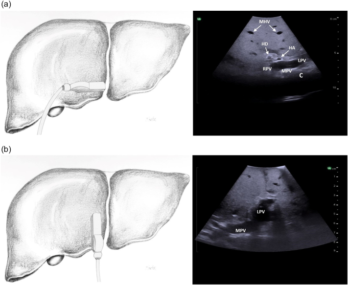 Fig. 16