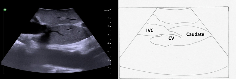 Fig. 13