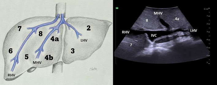 Fig. 10