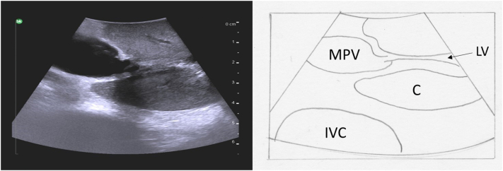 Fig. 32