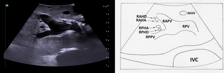 Fig. 22