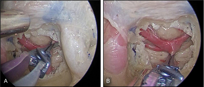 Fig. 5