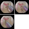 Fig. 4