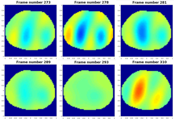 Fig. 15.