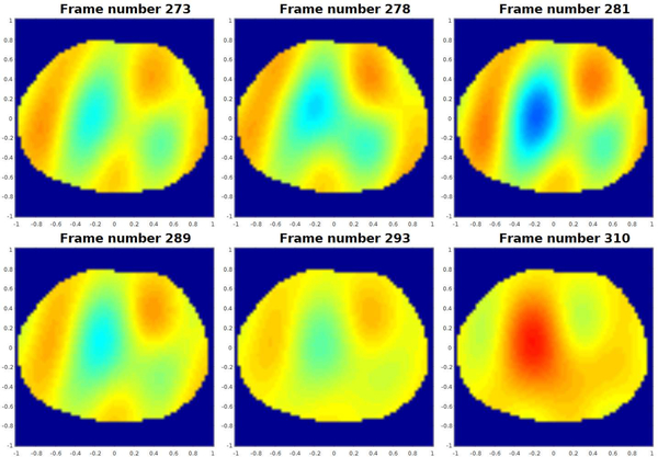 Fig. 14.