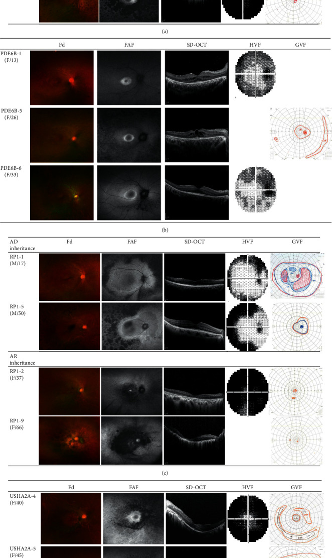 Genetic Profile and Associated Characteristics of 150 Korean Patients ...