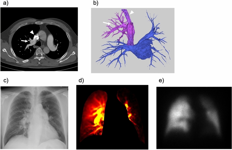 Fig. 20