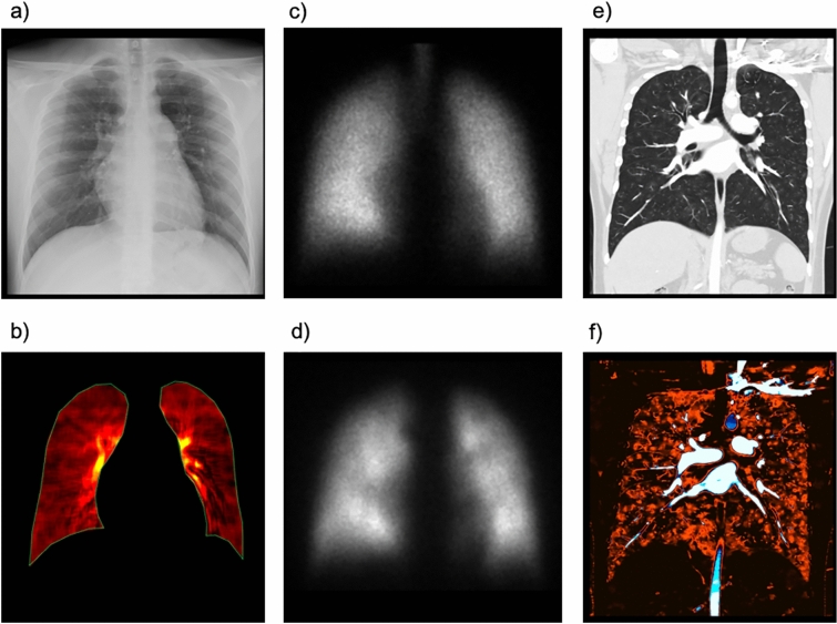 Fig. 10