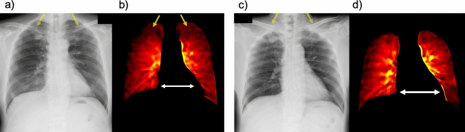 Fig. 15