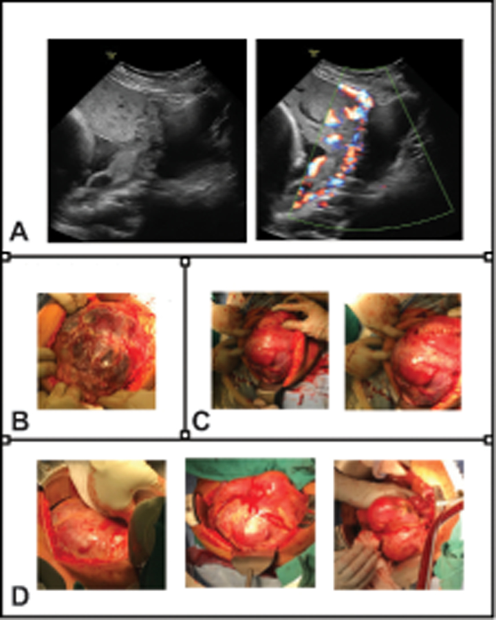 Figure 2: