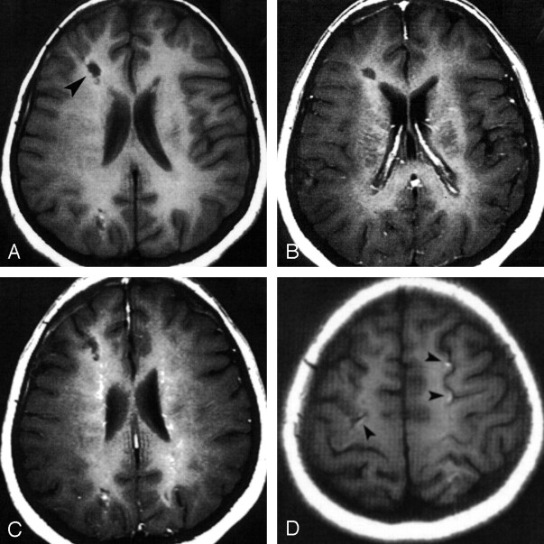 Fig 3.