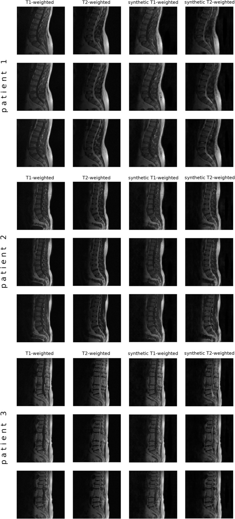 Fig. 4