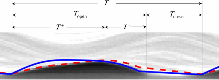 FIG. 5.