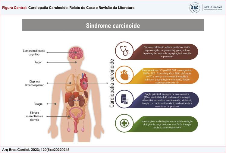 Figura Central