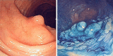 Fig. 4