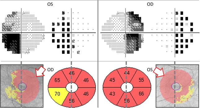 Figure 15b