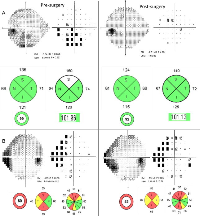 Figure 16