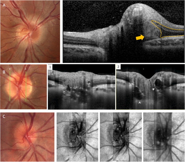 Figure 11