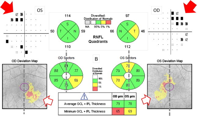 Figure 15a