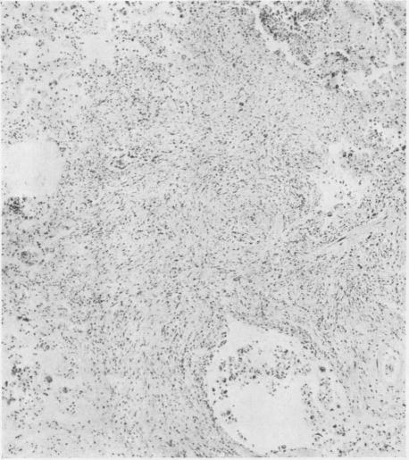 graphic file with name brjindmed00251-0068-a.jpg