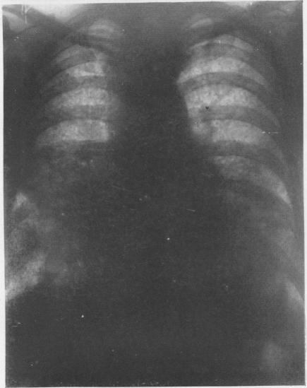graphic file with name brjindmed00251-0067-c.jpg